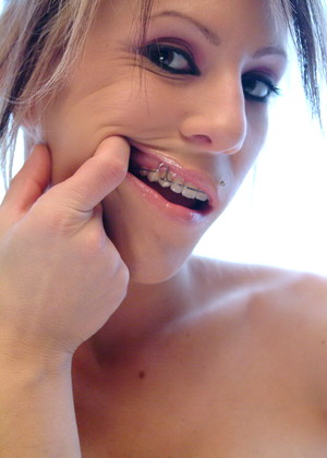 Beautyandbraces Model